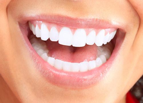 woman smiling after a cosmetic dentistry exam in vienna va