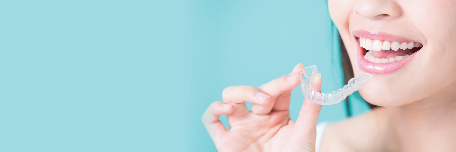 invisalign clear braces | vienna va 