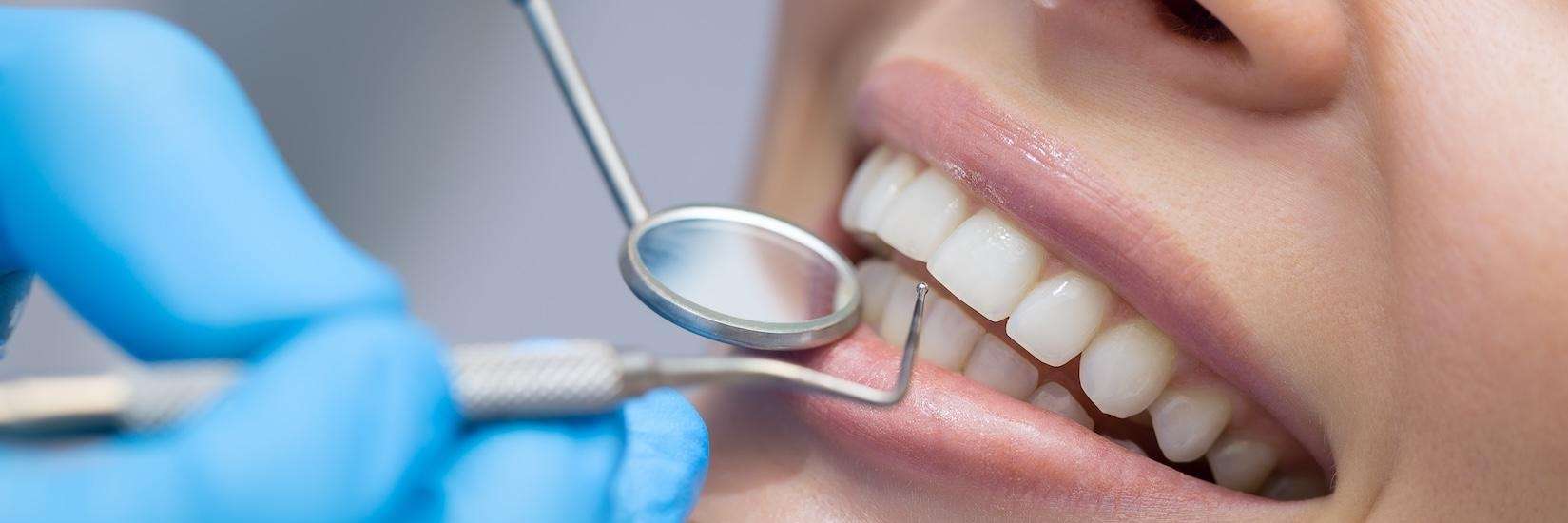 woman enjoys a dental cleaning session, highlighting the safety of teeth whitening procedures