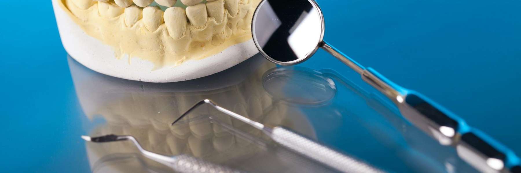 A teeth mold and dental tools | Vienna VA dentist
