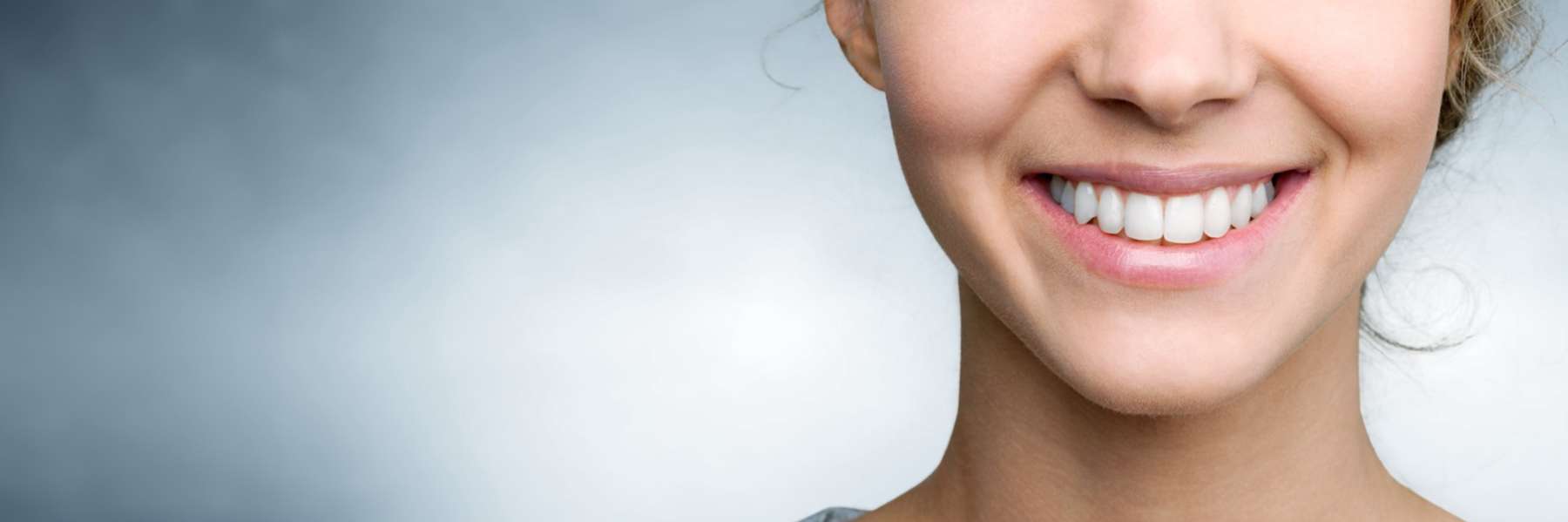 Full Smile Makeovers | Dentist