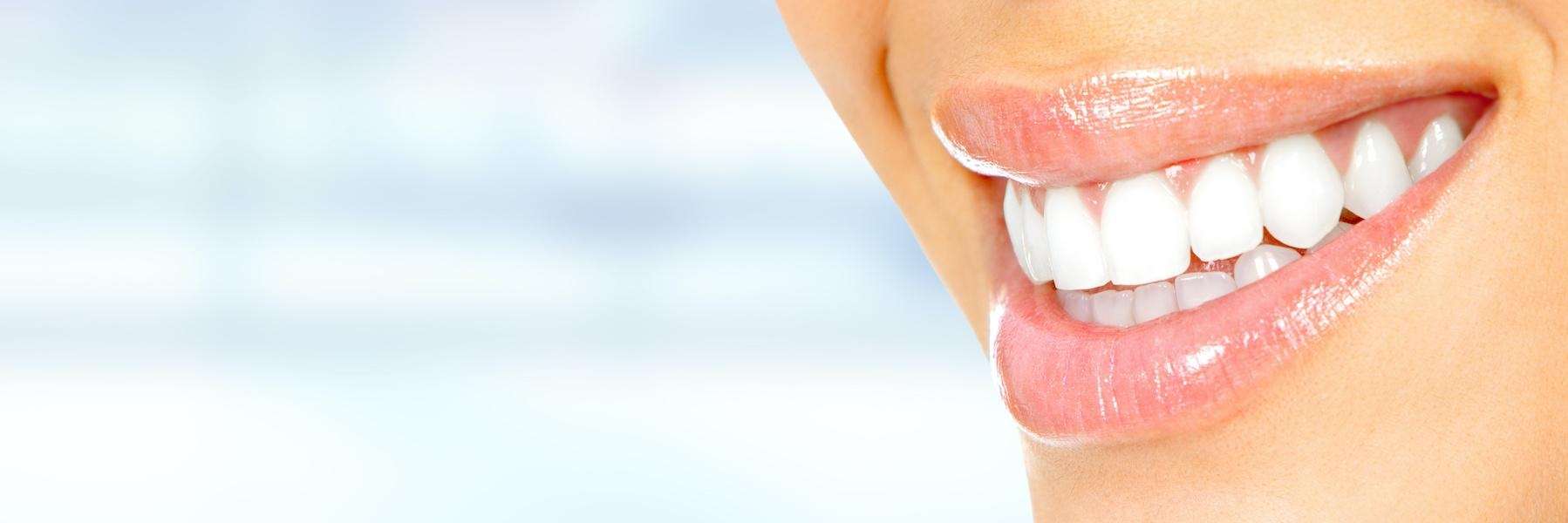 Gummy Smile Correction | Dentist