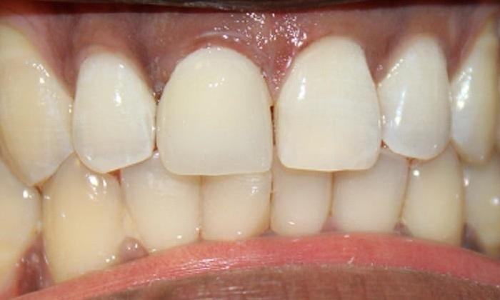 Cosmetic-Dentistry-After-Image
