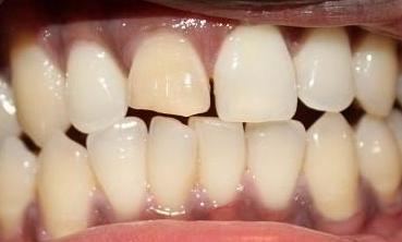 Cosmetic-Dentistry-Before-Image