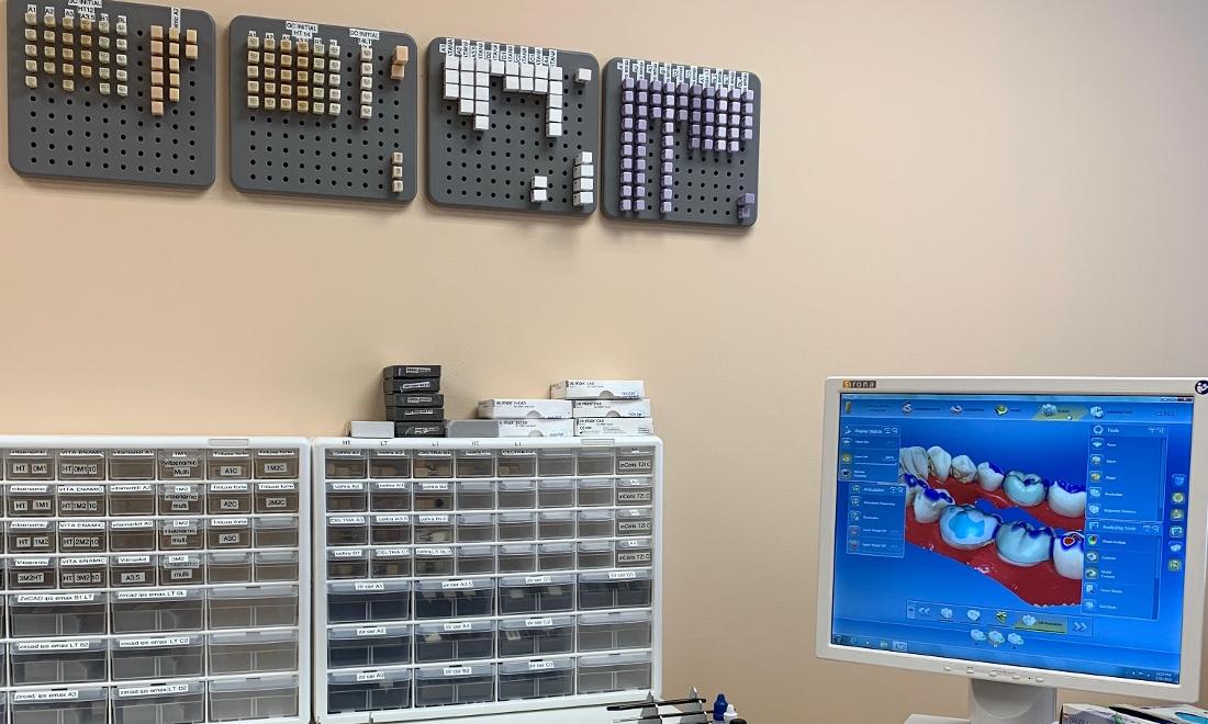 Cerec Same day Crowns at Tyson's Dentistry