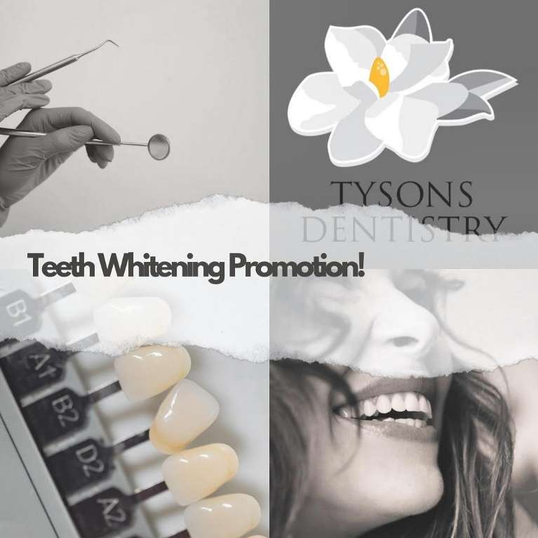 Teeth whitening Vienna, VA- Graphic